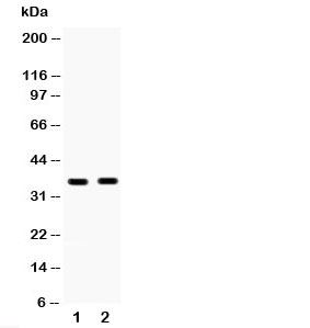 Western blot testing of HSD17B6 antibody and Lane 1:  human placenta;  2: MCF-7;  Predicted/observed molecular weight: ~35kDa.