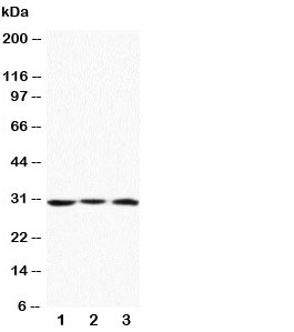 Western blot testing of Apolipoprotein D antibody and Lane 1:  MCF-7;  2: HeLa;  3: SMMC-7721 cell lysate. Predicted molecular weight: ~21/21-33kDa (unmodified/glycosylated). 