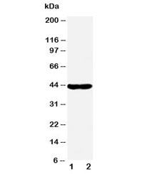 Western blot testing of NDRG1 antibody and SMMC-7721 nuclear (1) and cytoplasmic (2) fraction. Predicted molecular weight ~43kDa.