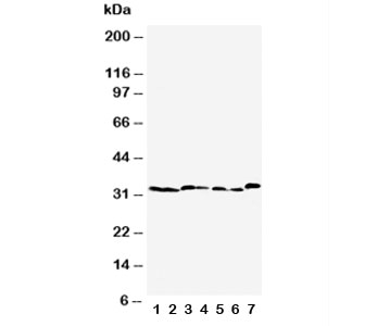 Western blot testing of Caspase-6 antibody  and Lane 1:  rat liver;  2: rat kidney;  3: rat testis;  4: NRK;  5: mouse liver;  6: mouse kidney;  7: mouse testis tissue lysate. Predicted molecular weight: ~33 kDa (precursor).