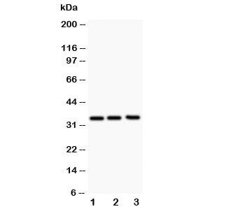 Western blot testing of GM-CSF antibody and Lane 1:  Jurkat;  2: HeLa;  3: HT1080;  The protein is visualized between 14~35KD depending on glycosylation.