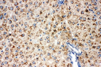 IHC staining of FFPE rat liver tissue with Lipoamide Dehydrogenase antibody. HIER: boil tissue sections in pH6 citrate buffer for 20 min and allow to cool before testing.