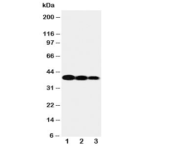 Western blot testing of IL12 p40 antibody and Lane 1:  recombinant human protein 10ng;  2: 5ng;  3: 2.5ng