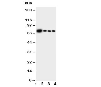 Western blot testing of GCLC antibody and Lane 1:  rat brain;  2: rat kidney;  3: rat heart;  4: rat lung tissue lysate