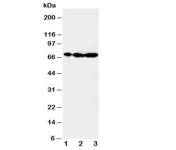 Western blot testing of MEKK2 antibody and Lane 1:  rat brain;  2: rat testis;  3: rat lung tissue lysate