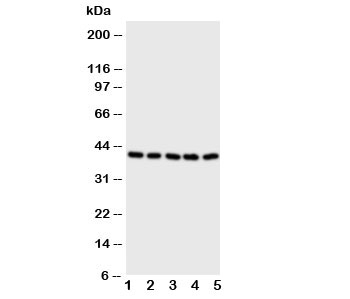 Western blot testing of BCAT2 antibody and Lane 1:  A431;  2: SW620;  3: SMMC-7721;  4: Jurkat;  5: CEM cell lysate