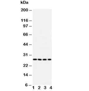 Western blot testing of Bcl10 antibody and Lane 1:  U87;  2: MCF-7;  3: HeLa;  4: COLO320 cell lysate. Observed molecular weight: 26~33 kDa.
