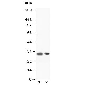 Western blot testing of BOB-1 antibody and Lane 1:  rat spleen tissue lysate. Predicted molecular weight: ~28/35-40kDa (unmodified/ubiquitinated).
