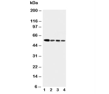 Western blot testing of Caspase-10 antibody and human tumor cell lysates 1:  COLO320;  2: HeLa;  3: SW620;  4: Raji. 