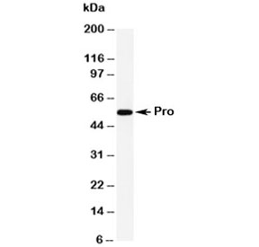 Western blot testing of Caspase-8 antibody and human HeLa cell lysate. Predicted molecular weight: ~55 kDa (pro), ~40 kDa (large + small subunit), ~11 kDa (small subunit).