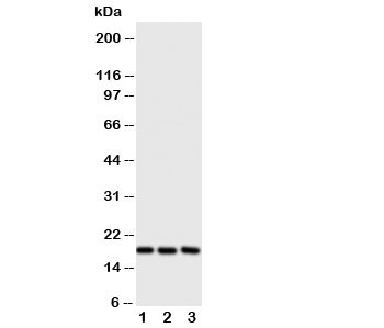 Western blot testing of I-309 antibody and Lane 1:  SCG;  2: COLO320;  3: Jurkat cell lysate.  Expeced size ~11KD, observed size ~17KD