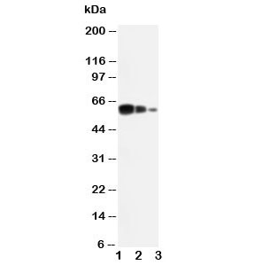 Western blot testing of ADAM10 antibody and Lane 1:  recombinant human protein 10ng;  2: 5ng;  3:  2.5ng