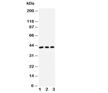 Western blot testing of DAPK2 antibody and Lane 1:  U87;  2: MCF-7;  3: SMMC-7721 cell lysate