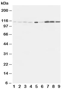 Western blot testing of EphA1 antibody and Lane 1:  rat liver;  2: (r) lung;  3: (r) intestine;  4: (r) ovary;  5: U87;  6: A549;  7: COLO320;  8: SW620;  9: HeLa cell lysate. Predicted molecular weight: ~108kDa.