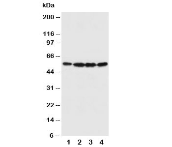 Western blot testing of Fascin antibody and Lane 1:  U87;  2: A549;  3: MCF-7;  4: HT1080 cell lysate. Predicted molecular weight ~55kDa.