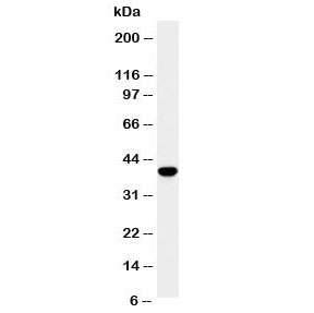 Western blot testing of SPARC antibody and HeLa cell lysate.  Expected molecular weight: 35-43 kDa depending on glycosylation level.