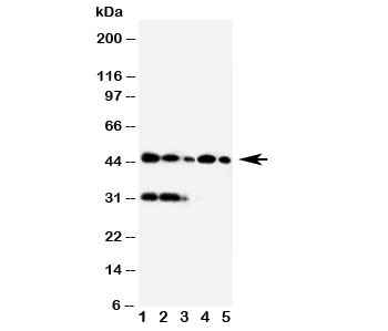 Western blot testing of Haptoglobin antibody and Lane 1: Raji;  2:HL-60;  3:HUT102;  4:Jurkat;  5:CEM cell lysate. Predicted molecular weight: 35-40 kDa (beta chain), 45-50 kDa (alpha + beta chain).