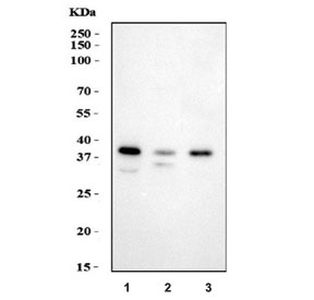 Western blot testing of 1) human T-47D, 2) human 293T and 3) rat C6 cell lysate with HSD17B1 antibody. Predicted molecular weight ~35 kDa.