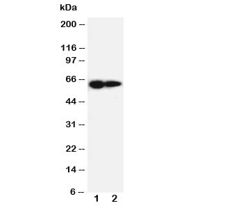 Western blot testing of IL-2 Receptor antibody and Lane 1:  PANC cell lysate ;  2: HeLa cell lysate.  Expected molecular weight ~61 kDa (unmodified), 70-75 kDa (glycosylated).