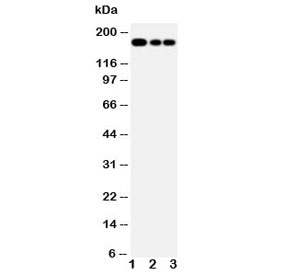 Western blot testing of MRP1 antibody and Lane 1:  Jurkat;  2: CEM;  3: A549 lysate. Predicted molecular weight: 152-172 kDa (multiple isoforms), can be observed at ~190 kDa.