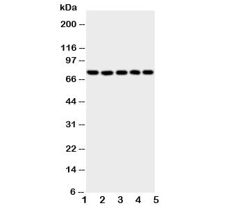 Western blot testing of 5-Lipoxygenase antibody and Lane 1:  SW620;  2: Jurkat;  3: COLO320;  4: A549;  5: MCF-7 cell lysate.  Predicted/observed size ~78KD