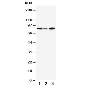 Western blot testing of MCM5 antibody and Lane 1:  rat testis;  2: rat brain;  3: Jurkat cell lysate. Expected molecular weight: 80~90 kDa.