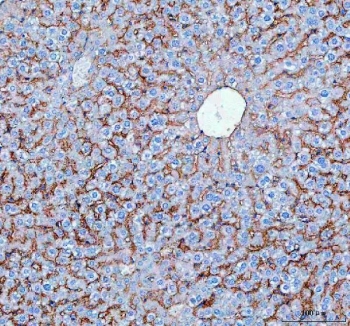 IHC staining of FFPE human mouse liver tissue with SLC10A1 antibody. HIER: boil tissue sections in pH8 EDTA for 20 min and allow to cool before testing.