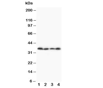 Western blot testing of Stra8 antibody and Lane 1:  A231;  2: Jurkat;  3: HT1080;  4: SCG cell lysate.  Predicted size: ~37KD