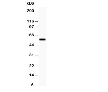 Western blot testing of SSTR2 antibody and rat lung lysate.  The protein is routinely visualized from 41~80KD, due to glycosylation.