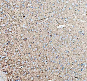 IHC staining of FFPE mouse brain tissue with TNR antibody. HIER: boil tissue sections in pH8 EDTA for 20 min and allow to cool before testing.