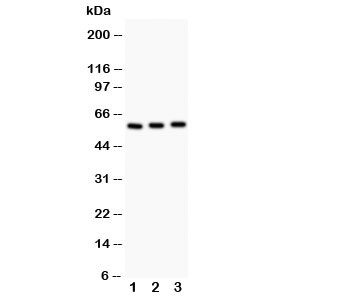 Western blot testing of CYP11A1 antibody and Lane 1:  rat testis;  2: mouse testis;  3: mouse brain; Expected molecular weight: 50-60 kDa.