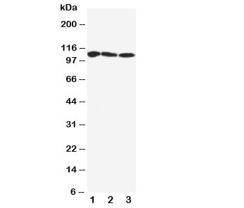 Western blot testing of SERCA1 ATPase antibody and Lane 1:  rat skeletal muscle;  2: human PANC;  3: (h) U87 cell lysate.  Observed size: 99-110KD