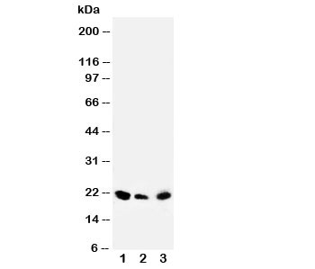 Western blot testing of DUSP3 antibody and Lane 1:  rat testis;  2: human SKOV;  3: (h) MM453 cell lysate. Predicted molecular weight ~20 kDa.