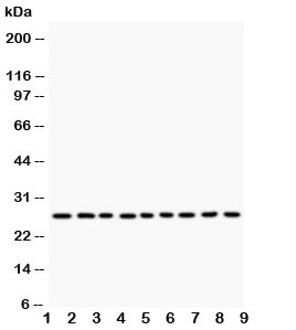 Western blot testing of Kallikrein 6 antibody and human lysate samples: 1)  MCF-7;  2) HeLa;  3) MM231;  4) MM453;  5) A549;  6) SMMC-7721;  7) COLO320;  8) SW620;  9) HT1080. Predicted molecular weight: ~27 kDa.