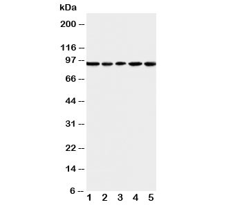 Western blot testing of MCM6 antibody and Lane 1:  U87;  2: COLO320;  3: HeLa;  4: MCF-7;  5: Jurkat cell lysate. Expected molecular weight: 92-105 kDa.
