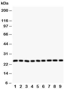 Western blot testing of SOD2 antibody and Lane 1:  rat liver;  2: (r) intestine;  3: (r) lung;  4: (r) heart;  5: human SMMC-7721;  6: (h) HeLa;  7: (h) COLO320;  8: (h) SW620;  9: (h) A549 cell lysate. Predicted molecular weight ~ 25 kDa.