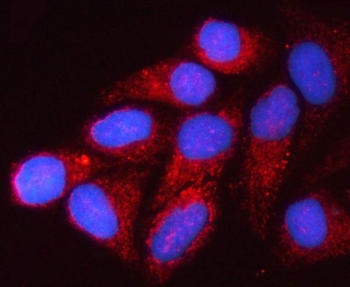 Immunofluorescent staining of FFPE human HeLa cells with VDAC1 antibody (red) and DAPI nuclear stain (blue). HIER: steam section in pH6 citrate buffer for 20 min.