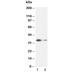 Western blot testing of Arginase 1 antibody and Lane 1:  rat liver ;  2: rat kidney lysate. Predicted molecular weight ~35 kDa.
