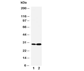 Western blot testing of LASP1 antibody and Lane 1:  HeLa;  2: MCF-7 cell lysate.  Predicted molecular weight: 30kDa.