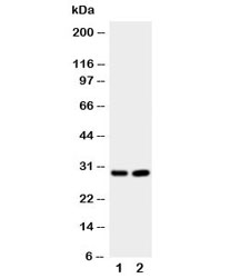 Western blot testing of Prion protein antibody and Lane 1:  rat brain;  2: rat brain.  Expected molecular weight: 20~29kDa.