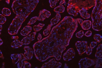 Immunofluorescent staining of FFPE human placental tissue with SSR3 antibody (red) and DAPI nuclear stain (blue). HIER: steam section in pH6 citrate buffer for 20 min.