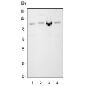 Western blot testing of 1) human MCF7, 2) rat RH35, 3) mouse ANA-1 and 4) mouse NIH 3T3 cell lysate with CBL antibody. Expected molecular weight: 100-120 kDa.