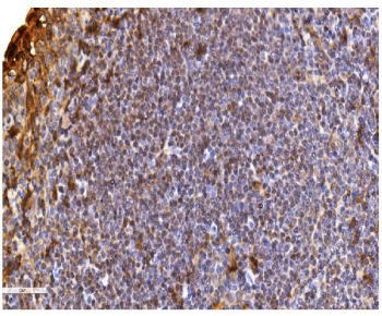 IHC staining of FFPE human tonsil with Daxx antibody. HIER: boil tissue sections in pH8 EDTA for 20 min and allow to cool before testing.