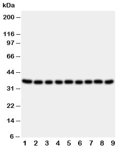 Western blot testing of Kallikrein 10 antibody and lysate from 1:  rat ovary;  2: rat testis;  3: rat spleen;  4: rat liver;  5: human 22RV;  6: human SROV;  7: human HeLa;  8: human MCF-7;  9: human MM231 cells. Predicted molecular weight ~37 kDa.
