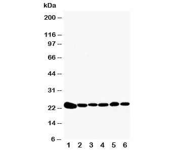 Western blot testing of Peroxiredoxin 2 antibody and Lane 1:  rat brain;  2: rat kidney;  3: HeLa;  4: Jurkat;  5: 293T;  6: A549 cell lysate.  Expected size: 23KD