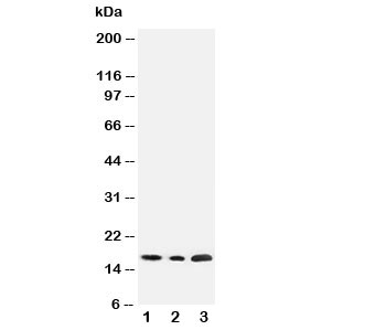 Western blot testing of SDHC antibody and Lane 1:  rat liver;  2: HeLa;  3: Jurkat cell lysate