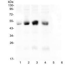 Western blot testing of human 1) A431, 2) HeLa, 3) HepG2, 4) Caco-2, 5) U973 and 6) THP1 cell lysate with CAR antibody at 0.5ug/ml. Expected molecular weight: 40-50 kDa.