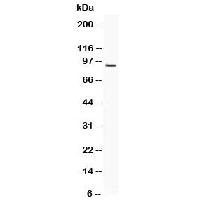 Western blot testing of FES antibody and human HeLa lysate. Predicted molecular weight ~93 kDa.