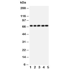 Western blot testing of SHP2 antibody and rat samples 1: heart;  2: skeletal muscle;  3: brain; and human samples 4: HeLa;  5: A549 cell lysate.  Predicted molecular weight: ~68 kDa.
