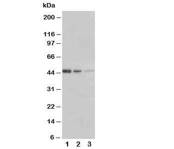 Western blot testing of ERBB3 antibody and Lane 1:  Recombinant human protein 5ng;  2: 2.5ng;  3: 1.25ng